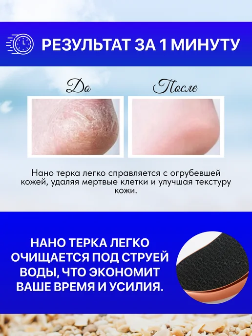 Терка для пяток с ручкой наностекло нанотерка, синий, фото 3