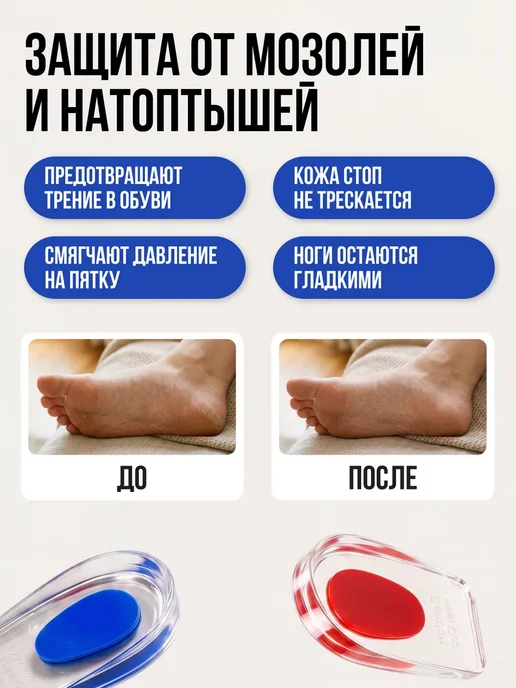 SPORT & COMFORT Силиконовые подпяточники универсальные, синий, фото 5