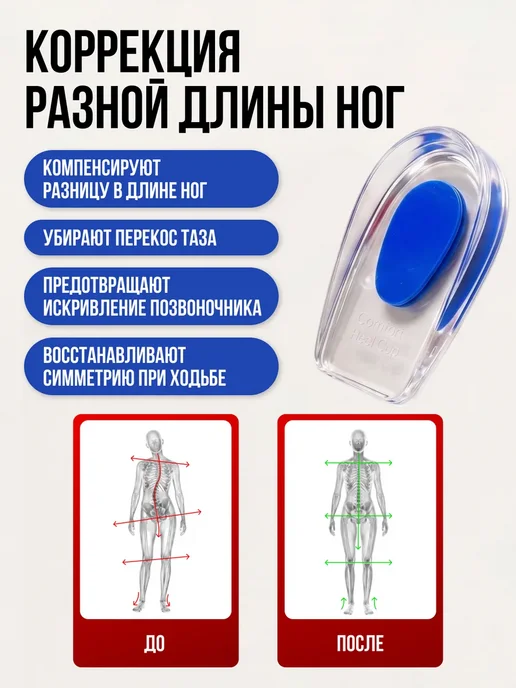 SPORT & COMFORT Силиконовые подпяточники универсальные, синий, фото 8