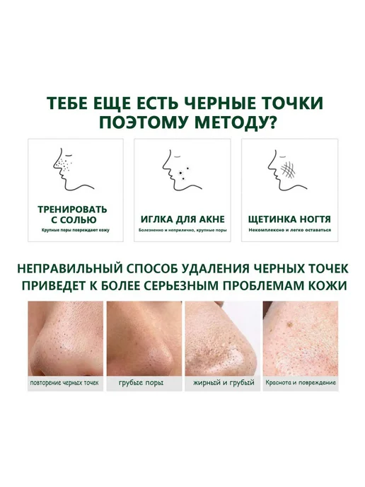 Иди к черноголовому Грязевая маска Удалите жир гладкий нос, черный, фото 4