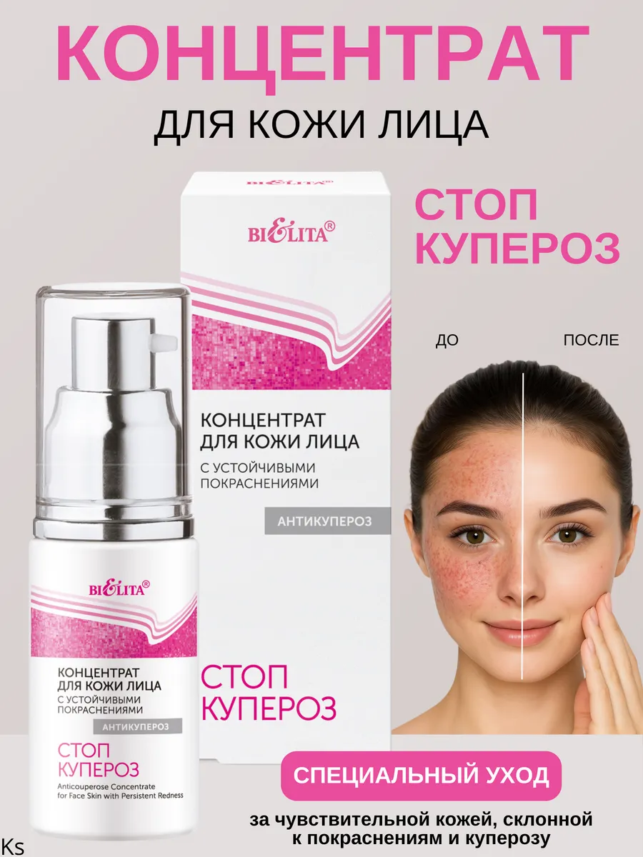Концентрат для лица с устойчивыми покраснениями Антикупероз