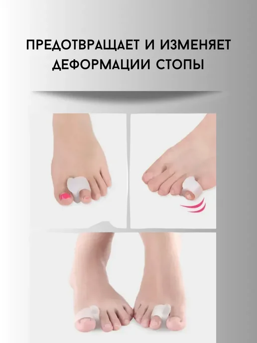 My Sweet Home Межпальцевый разделитель для пальцев ног от боли и натирании, белый, фото 2