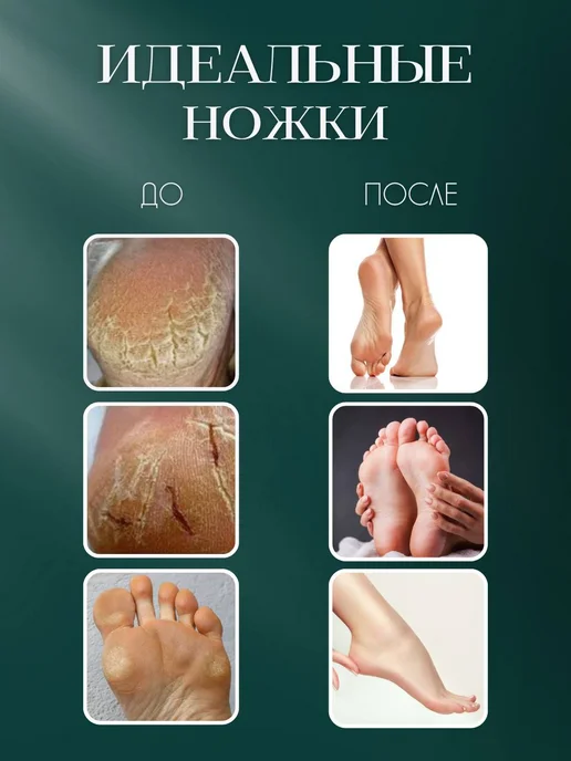 CMGF Педикюрный нож скребок для пяток и стоп с нанопилкой, оранжевый, фото 2