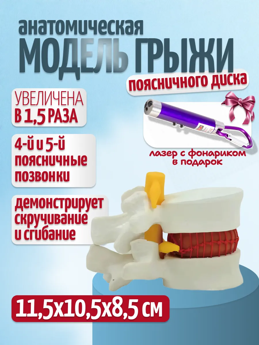 Анатомическая модель грыжи человека с фонариком