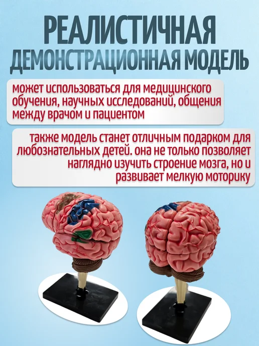 Retorsa Анатомическая модель грыжи человека с фонариком, вариант, фото 2