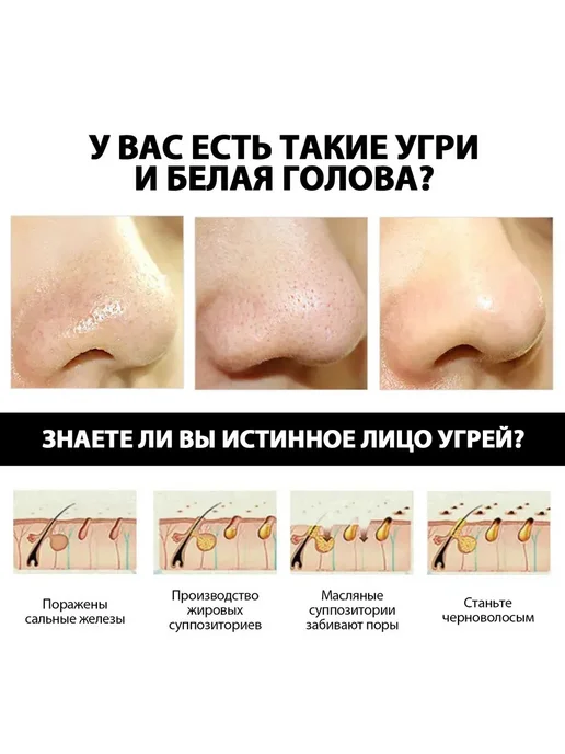 Увлажняет удаляет угри Грязевая пленка сужает поры, вариант, фото 3