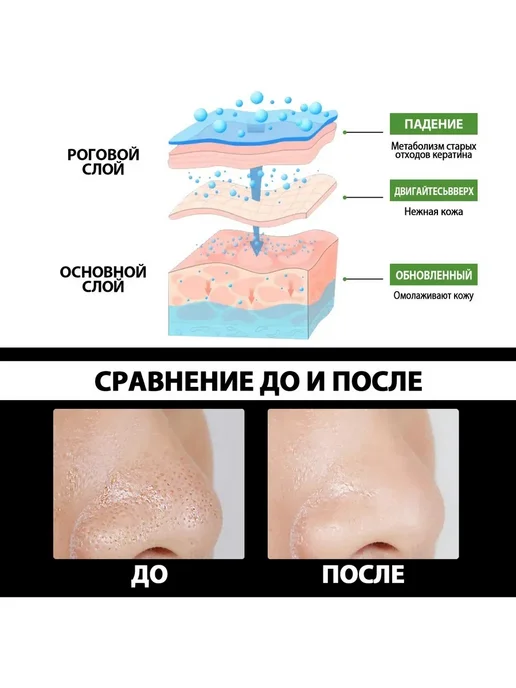 Увлажняет удаляет угри Грязевая пленка сужает поры, вариант, фото 4