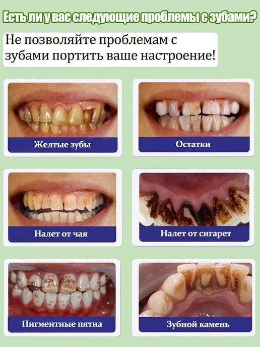 Зубная паста для удаления зубного камня, вариант, фото 4
