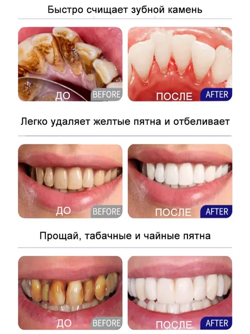 LYDIMOON лемонграсс зубная, китайская зубная паста, вариант, фото 4