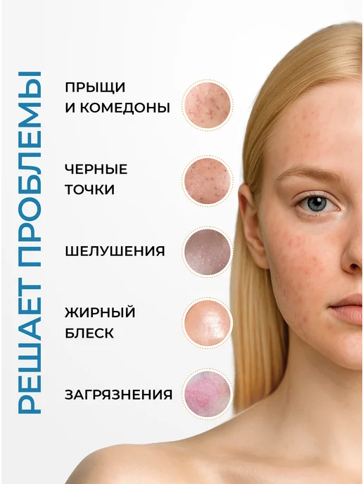 БьютиЦевтика Набор Акневицид без спирта от прыщей и несовершенств, белый, фото 4