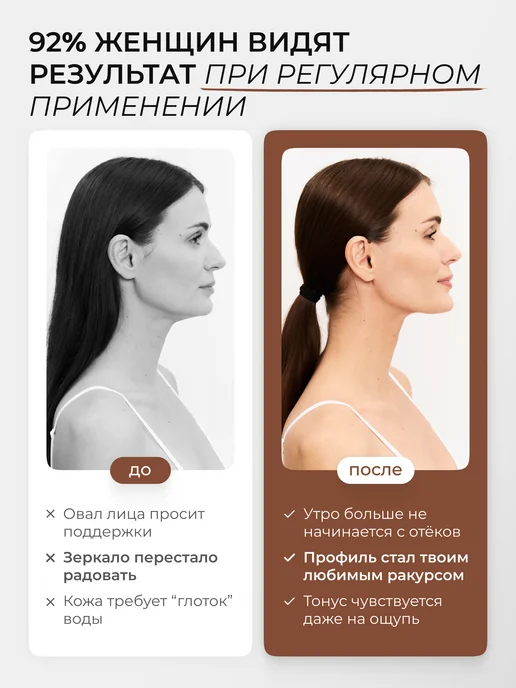 CuteSkin Гидрогелевые патчи от второго подбородка лифтинг, вариант, фото 4