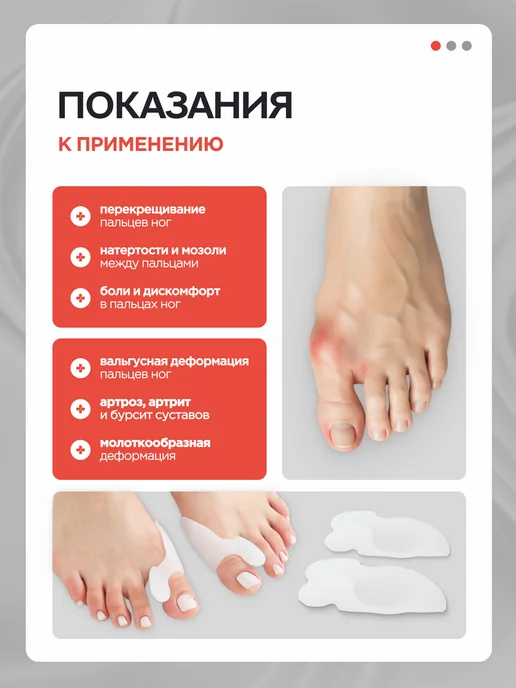 MEDKING Разделитель пальцев ног ортопедический вальгусный корректор, белый, фото 2