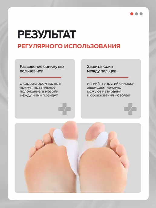 MEDKING Разделитель пальцев ног ортопедический вальгусный корректор, белый, фото 5